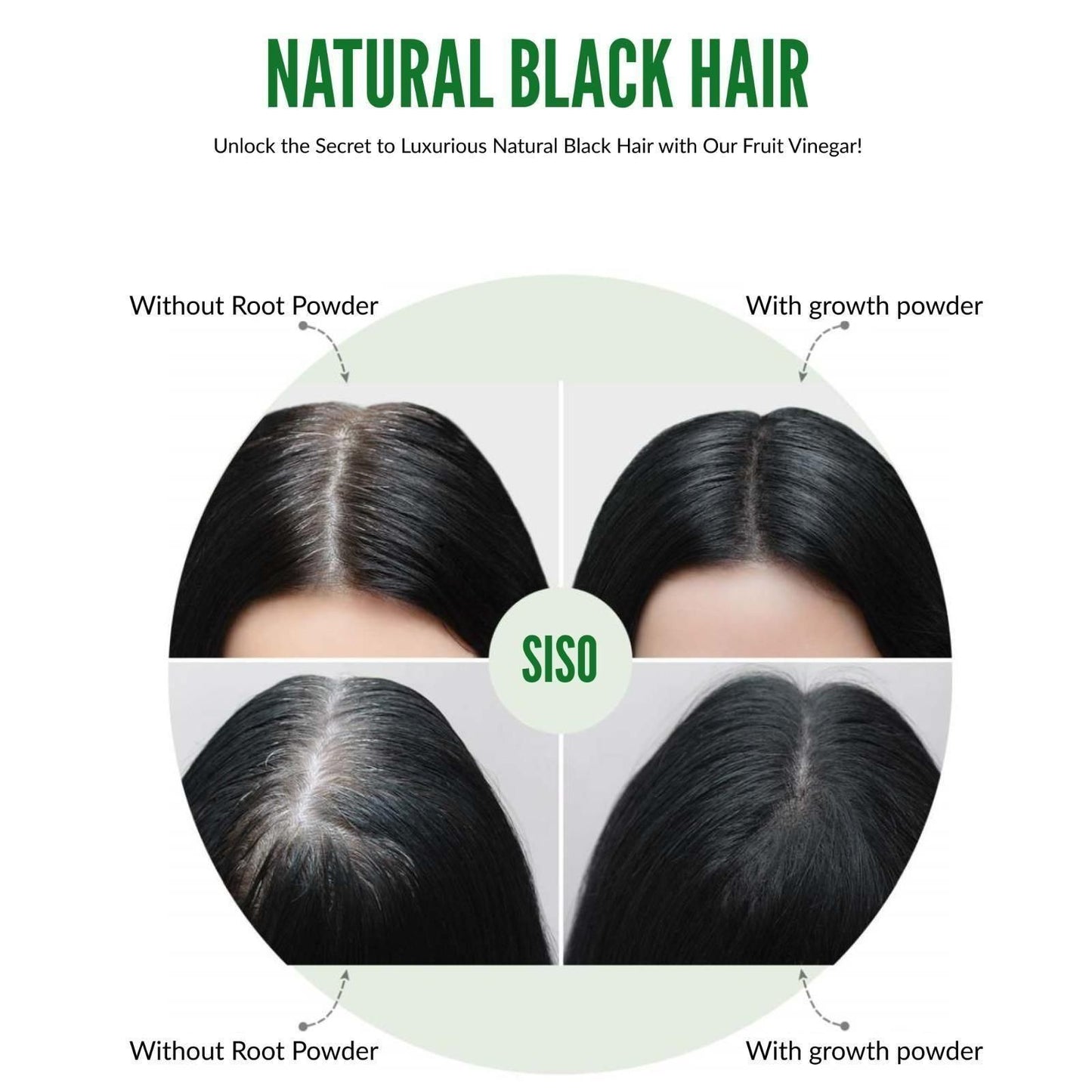 SISO FRUIT VINEGAR Shampoo (Pack of 2) 240ml